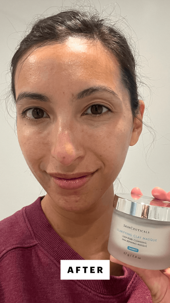 Pai after applying the SkinCeuticals Clarifying Clay Masque